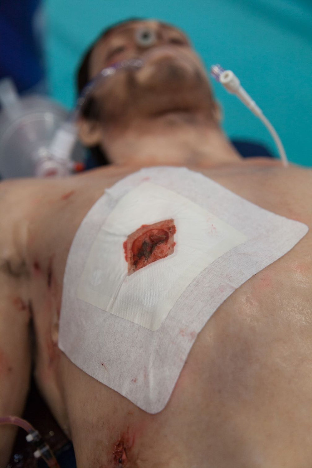 Russell Chest Seal applied to a simulated open chest wound on a manikin's torso during a medical training scenario.
