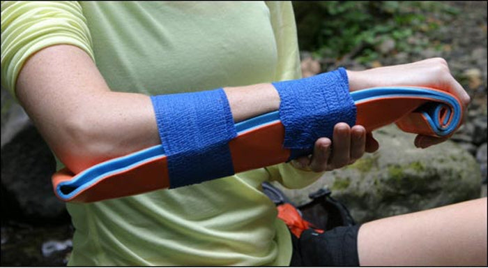 SAM Splint molded to forearm and secured with blue wrap during outdoor first aid scenario. Used for stabilising limb injuries in remote settings. TacMed Australia – essential wilderness and trauma response gear.