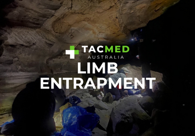 Limb Entrapment: Be a STARR to help your patient.