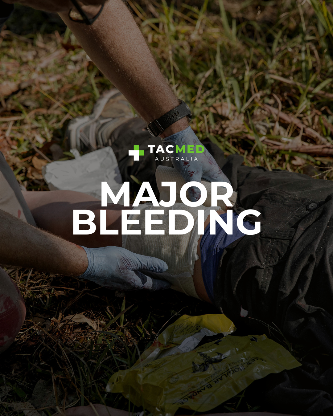 Major Bleeding: What It Is and What to Do