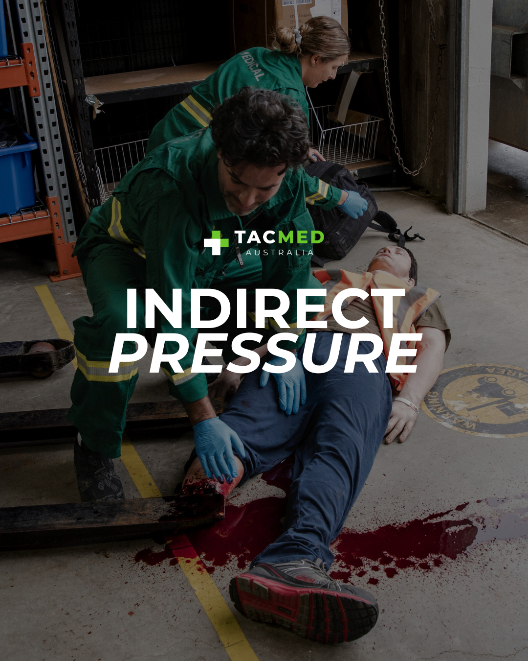 Indirect Pressure: A Lifesaving Bridge for Severe Bleeding