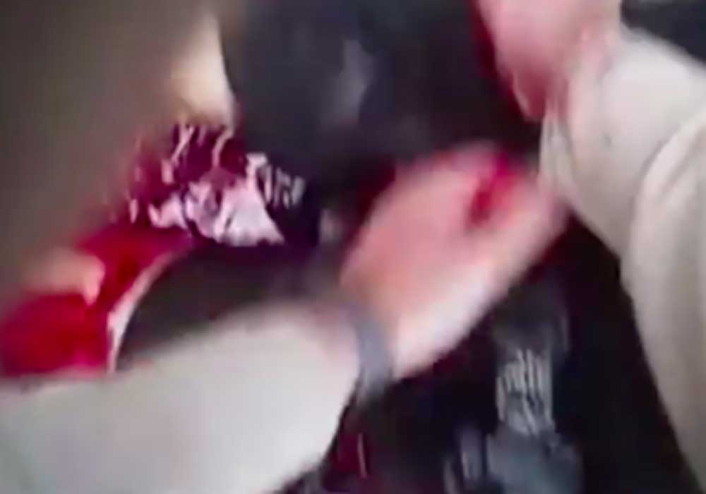 Video (GRAPHIC): Police shootout and Tourniquet life save