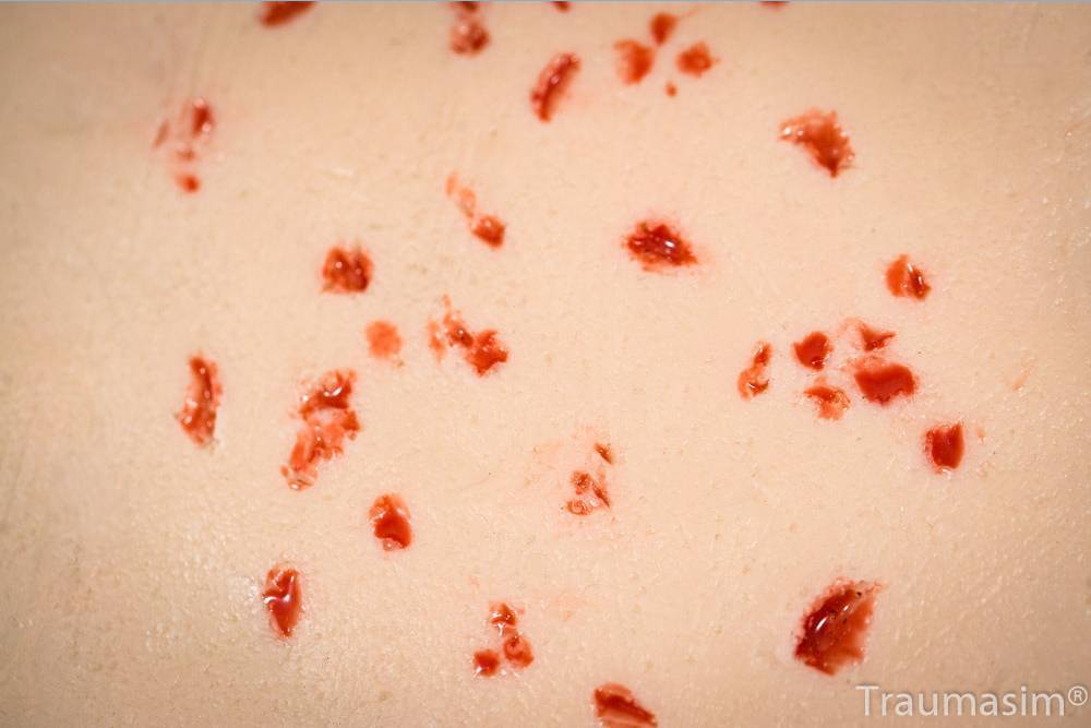 TraumaSim Fragmentation Spray 3