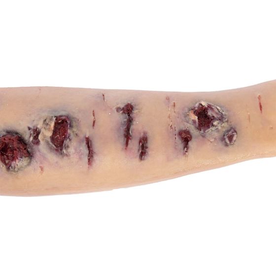 NAR Simulation - TOMManikin Replacement Limb