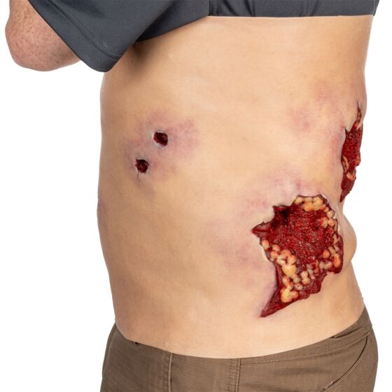 NAR Simulation - Multiple GSW Abdomen Wearable Wound