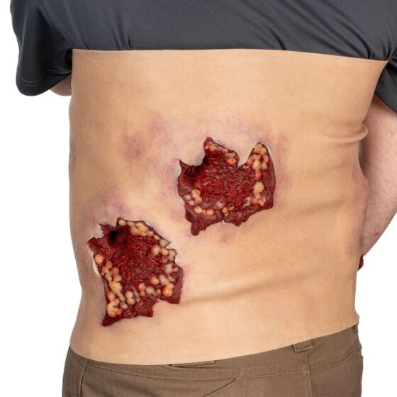 NAR Simulation - Multiple GSW Abdomen Wearable Wound