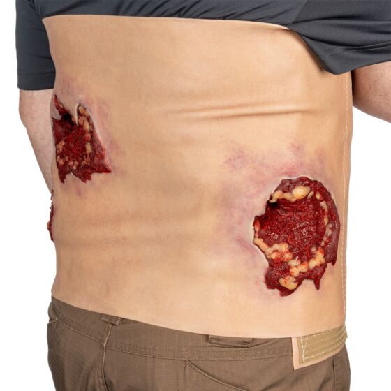 NAR Simulation - Multiple GSW Abdomen Wearable Wound