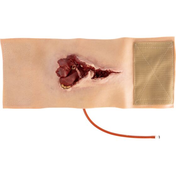 NAR Simulation - GSW Bicep Wearable Wound