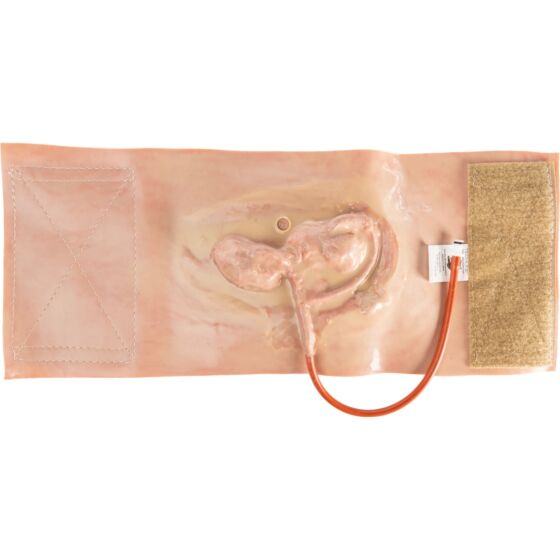 NAR Simulation - GSW Bicep Wearable Wound