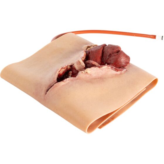NAR Simulation - GSW Bicep Wearable Wound