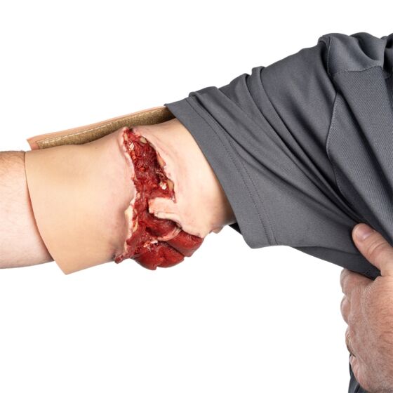 NAR Simulation - GSW Bicep Wearable Wound
