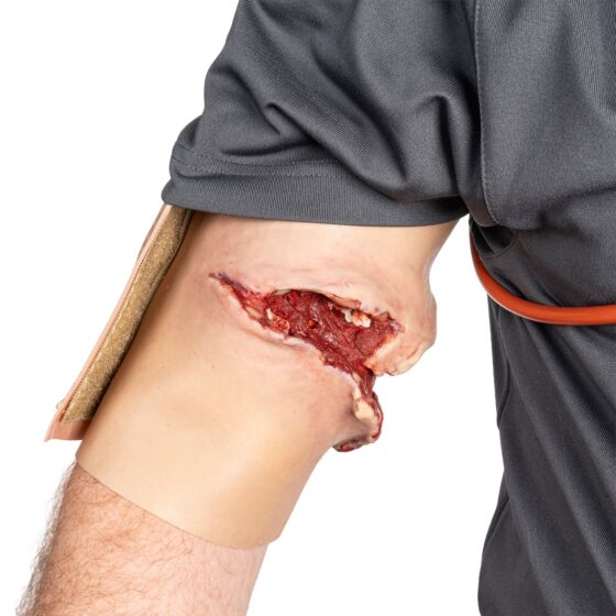NAR Simulation - GSW Bicep Wearable Wound