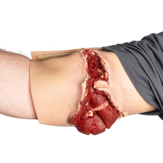 NAR Simulation - GSW Bicep Wearable Wound