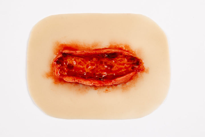 TraumaSim Laceration Open Fat Layer Large