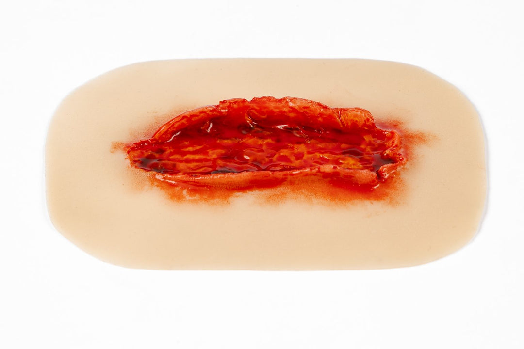TraumaSim Laceration Open Fat Layer Large