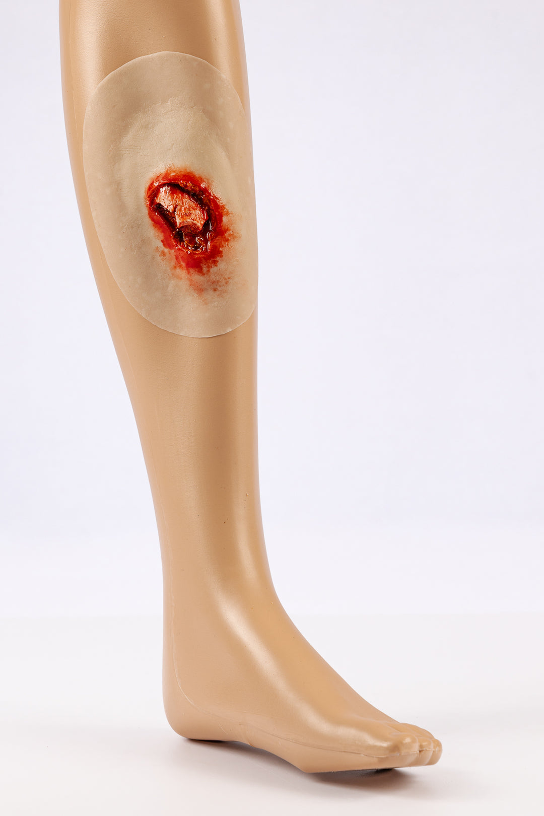 TraumaSim Open Fracture