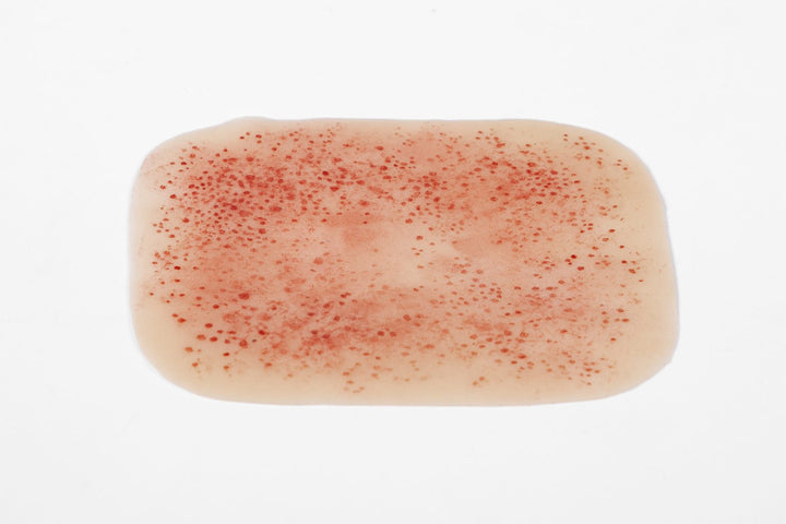 TraumaSim Rash - Meningococcal