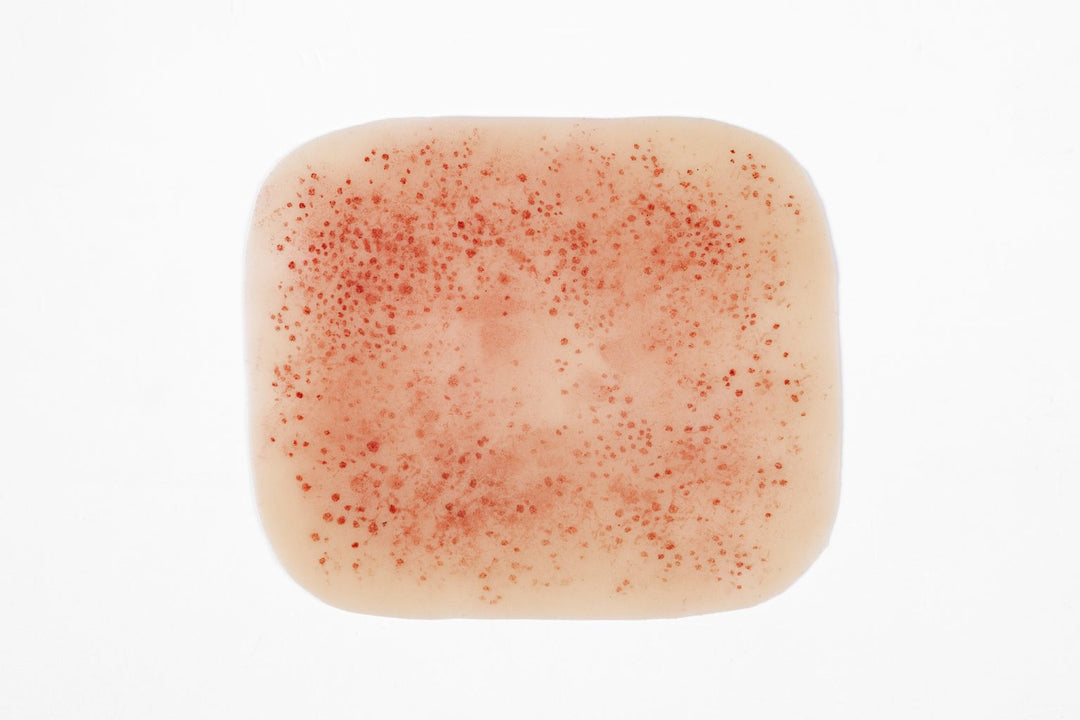 TraumaSim Rash - Meningococcal