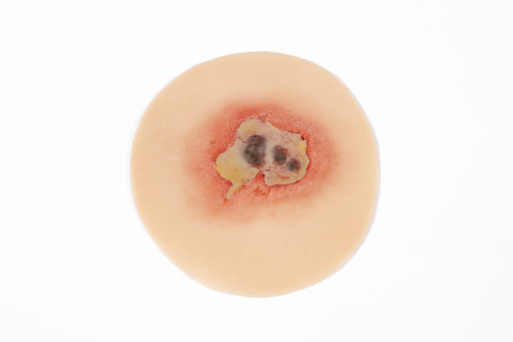 TraumaSim Infected Open Wound