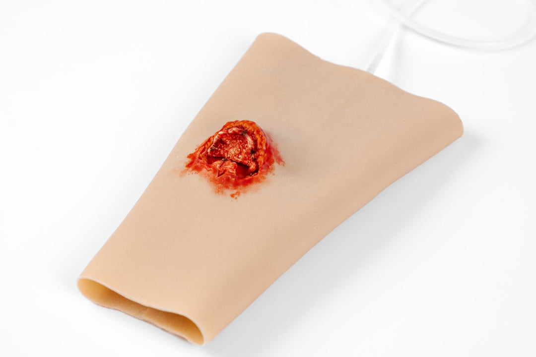 TraumaSim TraumaWear - Open Fracture Forearm