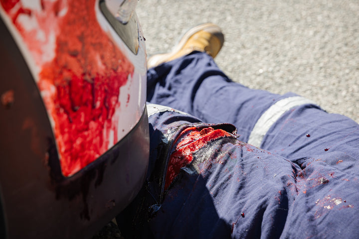 TraumaSim TraumaWear - Open Femur Fracture Upper Leg with Bleeding