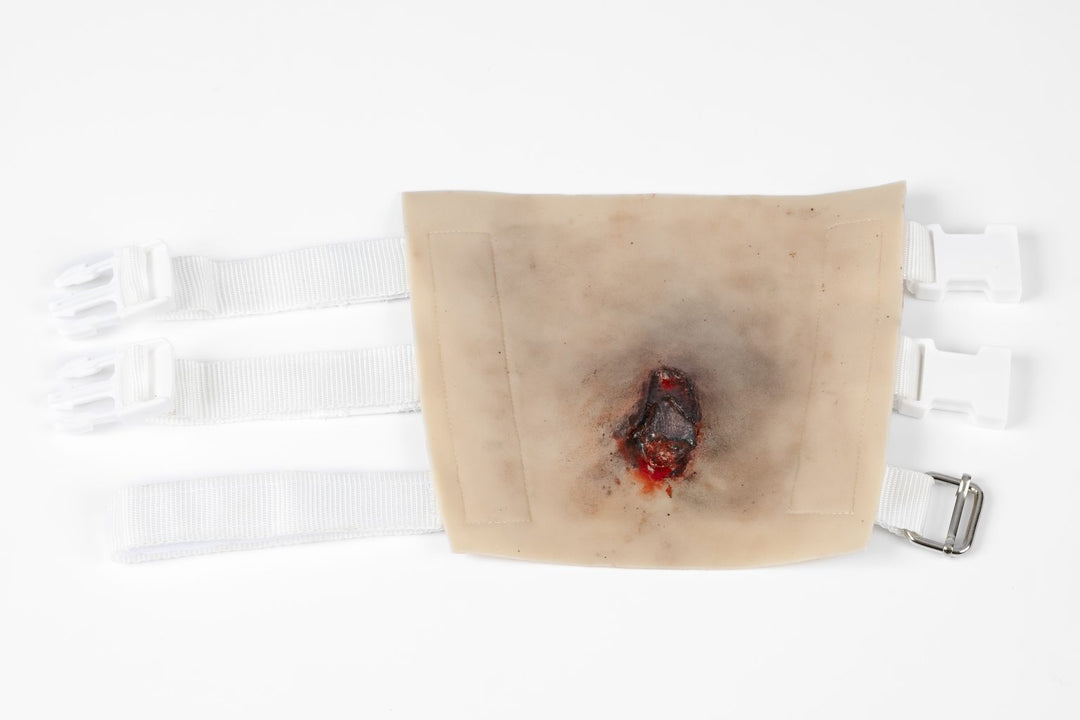 TraumaSim TraumaWear - Open Humerus Fracture