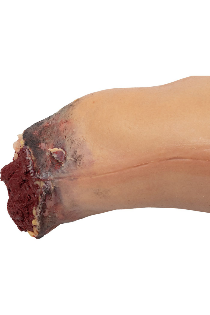 TOMManikin Blast close up of amputated leg injury