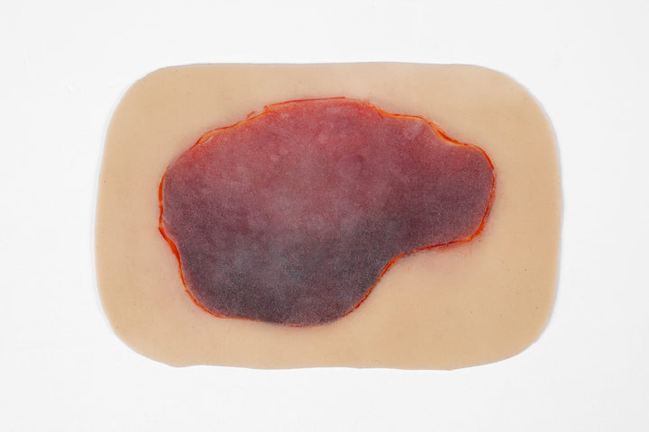 TraumaSim Clinical Skin Tear Range (6 wounds)