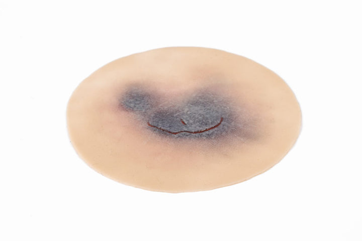 TraumaSim Clinical Skin Tear Range (6 wounds)