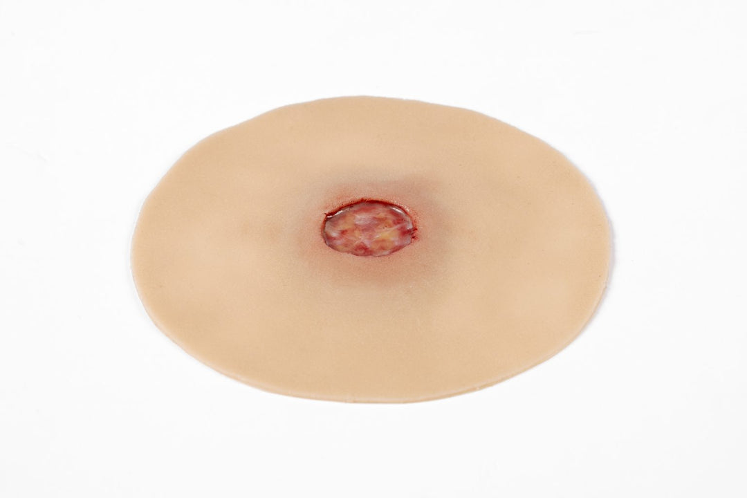 TraumaSim Clinical Ulcer Range (4 wounds)