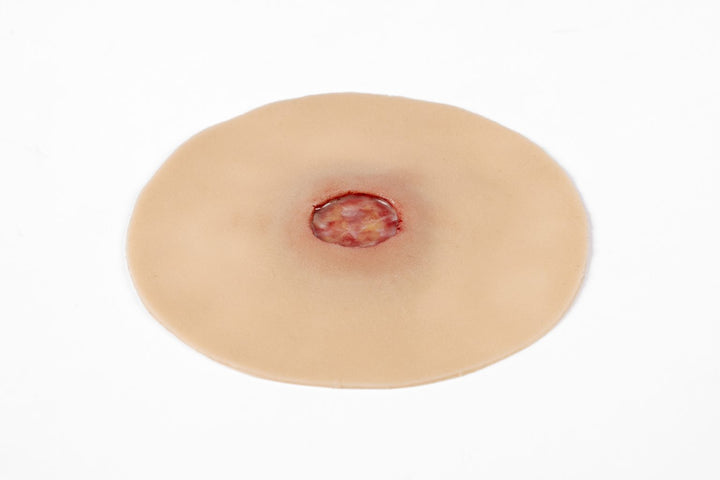 TraumaSim Clinical Ulcer Range (4 wounds)