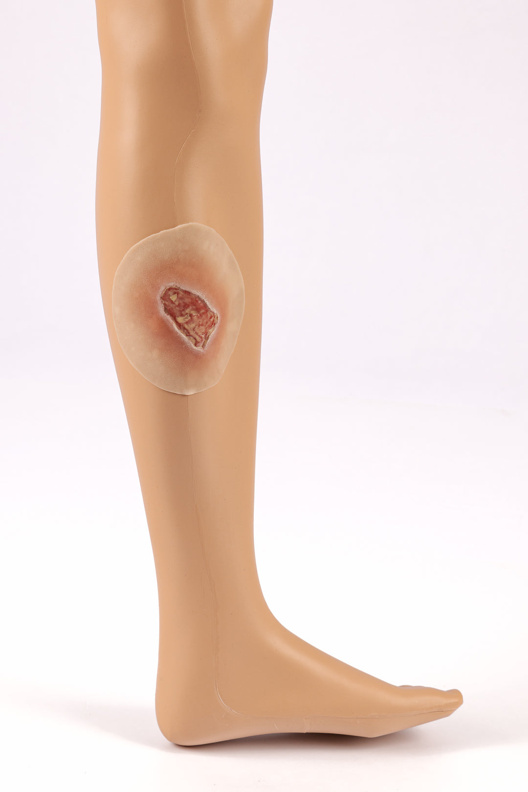 TraumaSim Clinical Ulcer Range (4 wounds)