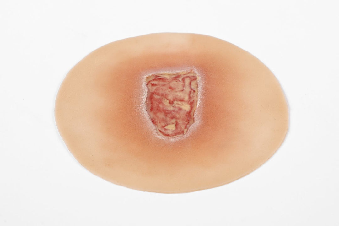 TraumaSim Clinical Ulcer Range (4 wounds)