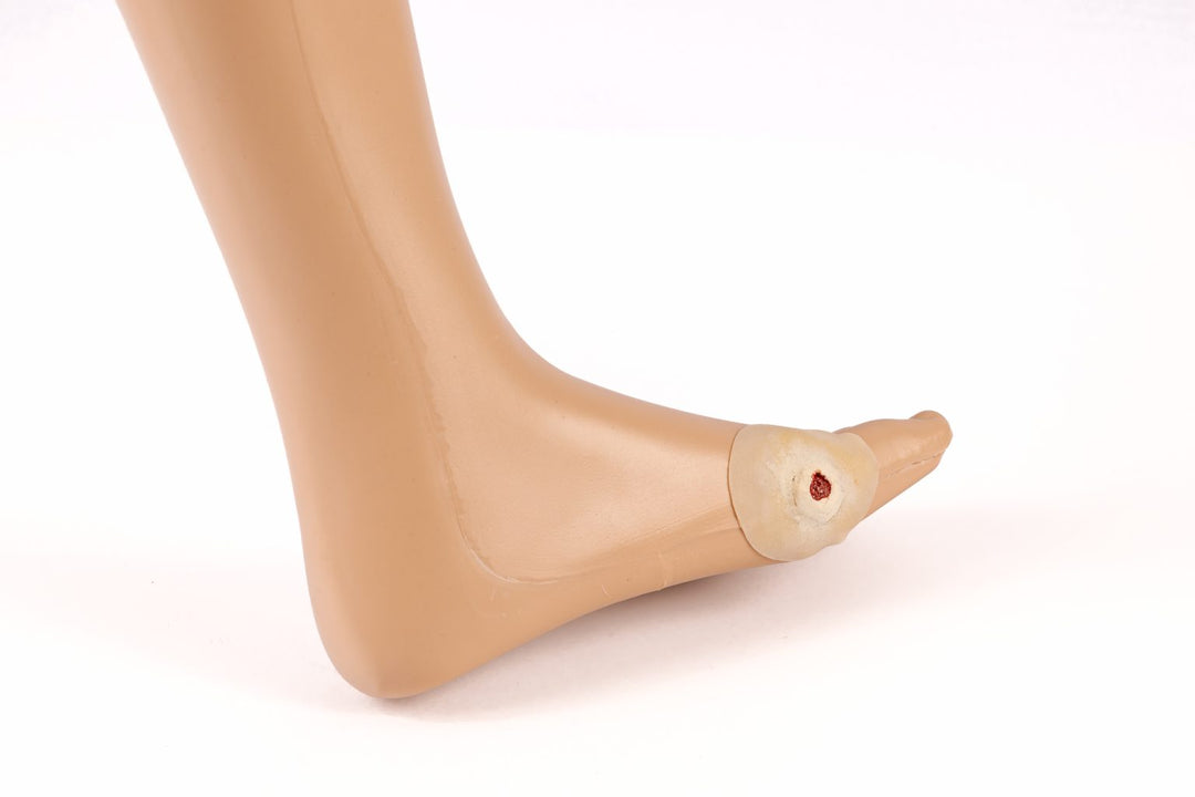 TraumaSim Clinical Ulcer Range (4 wounds)