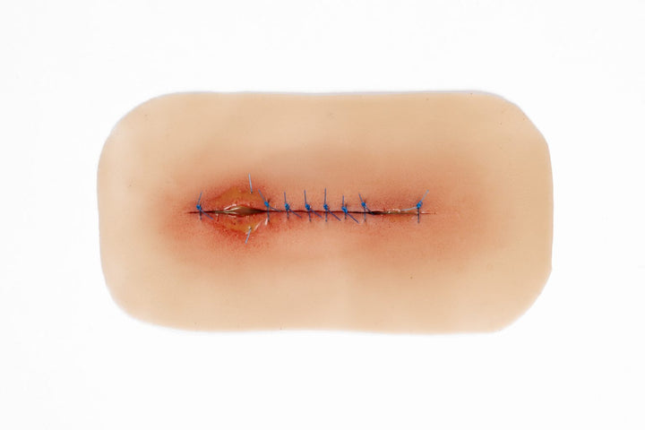 TraumaSim Suture Line Infected