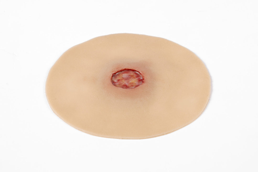 TraumaSim Ulcer - Leg Arterial