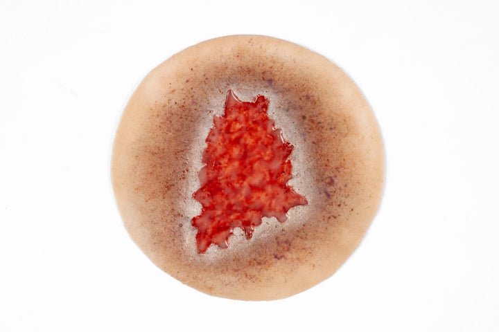 TraumaSim Ulcer - Leg Venous