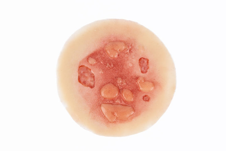 TraumaSim Burn Blistered