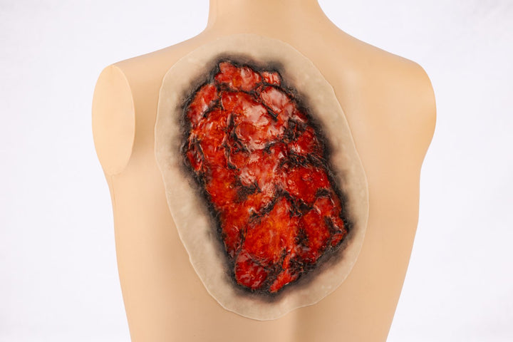 TraumaSim Burn Large