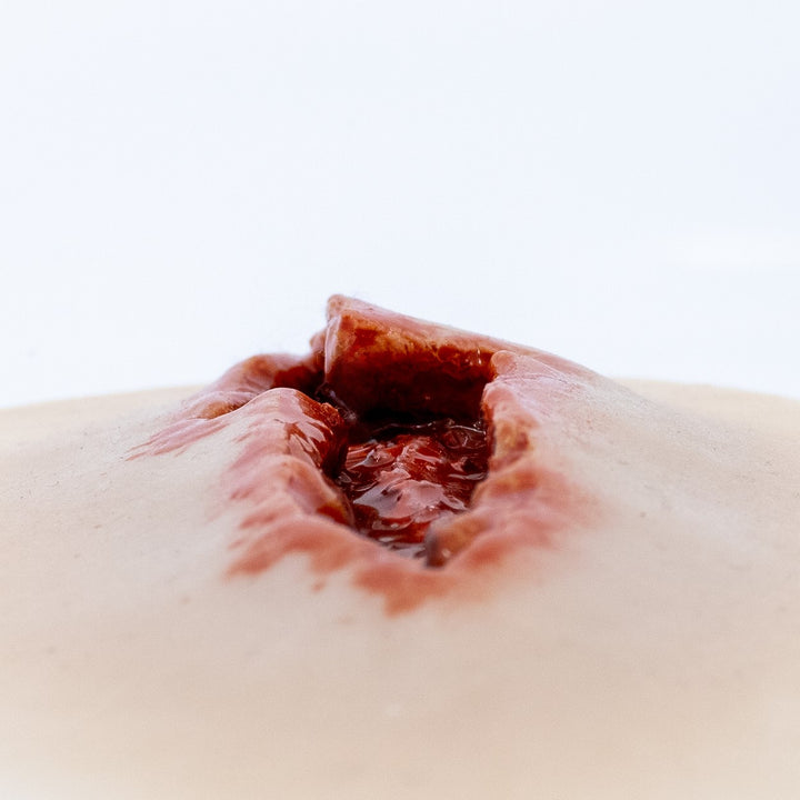 TraumaSim Laceration Jagged 3