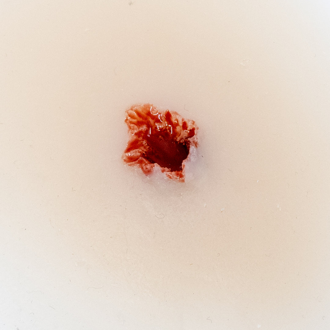 TraumaSim Fragmentation Single 1
