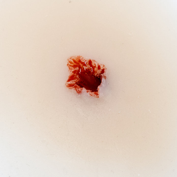 TraumaSim Fragmentation Single 1