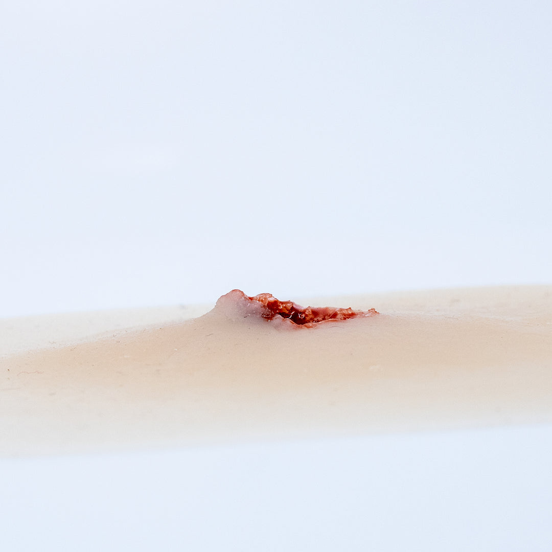 TraumaSim Fragmentation Single 1