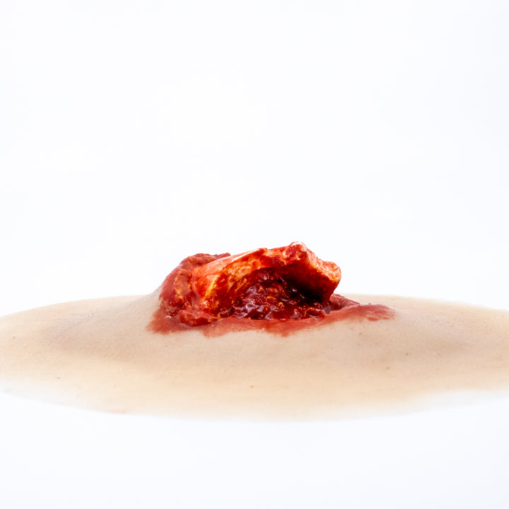 TraumaSim Open Fracture