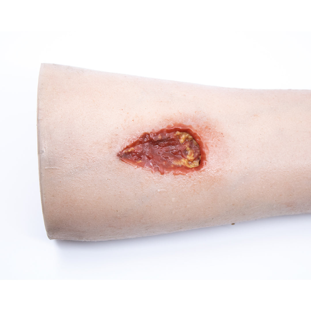 TraumaSim Arm with Bloody Wounds