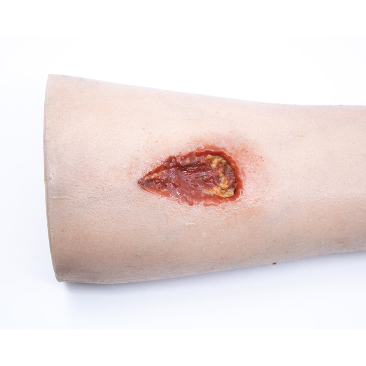 TraumaSim Arm with Bloody Wounds