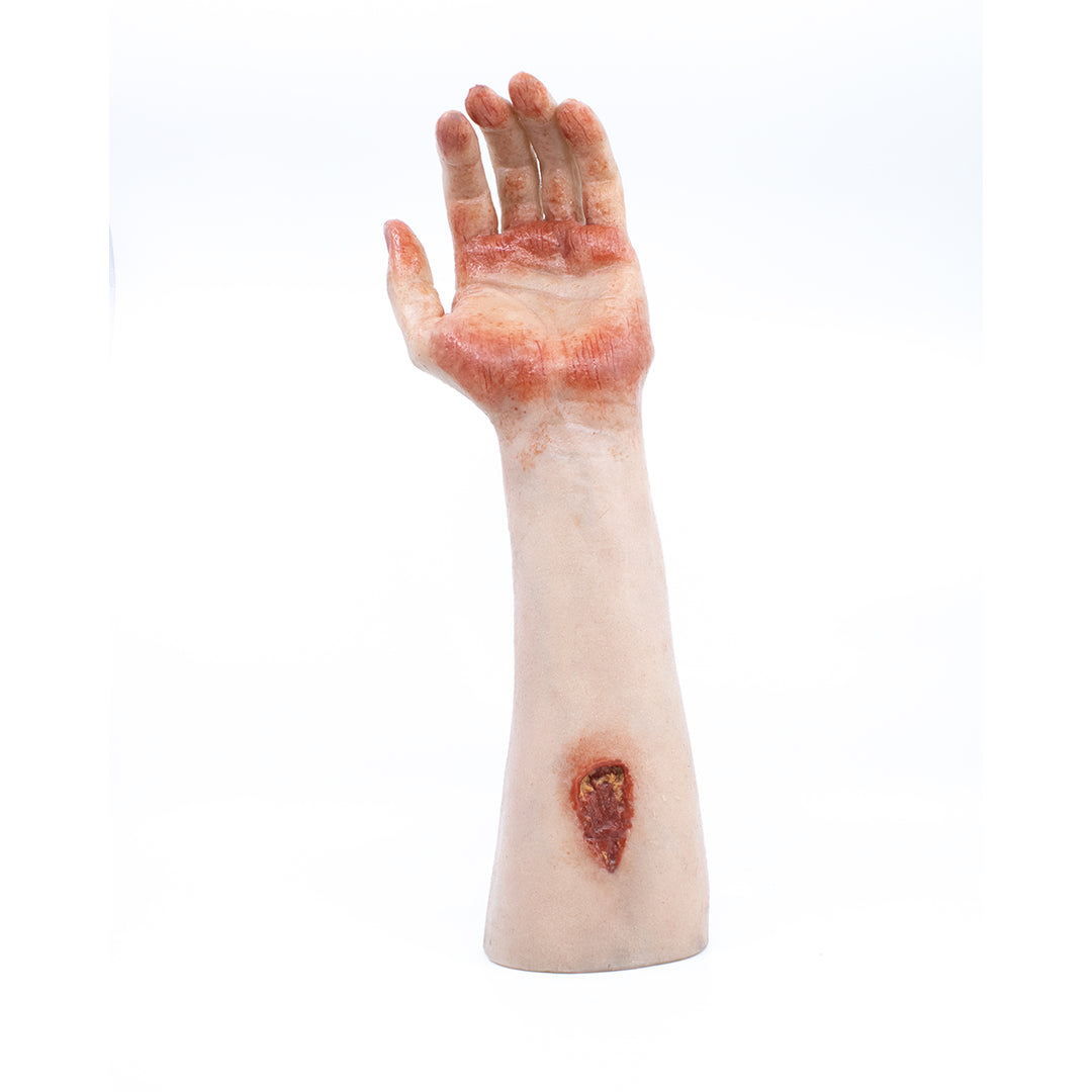 TraumaSim Arm with Bloody Wounds