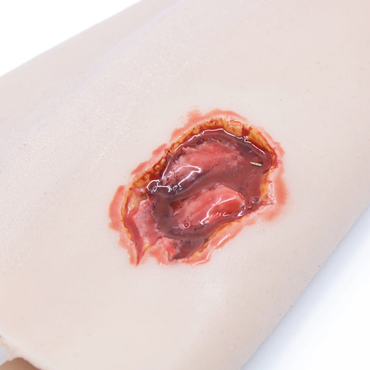 TraumaSim TraumaWear - Gunshot Entry/Exit Wound Forearm
