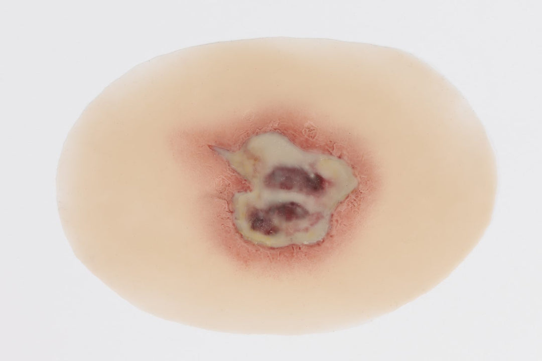 TraumaSim Clinical Various Range (5 wounds)