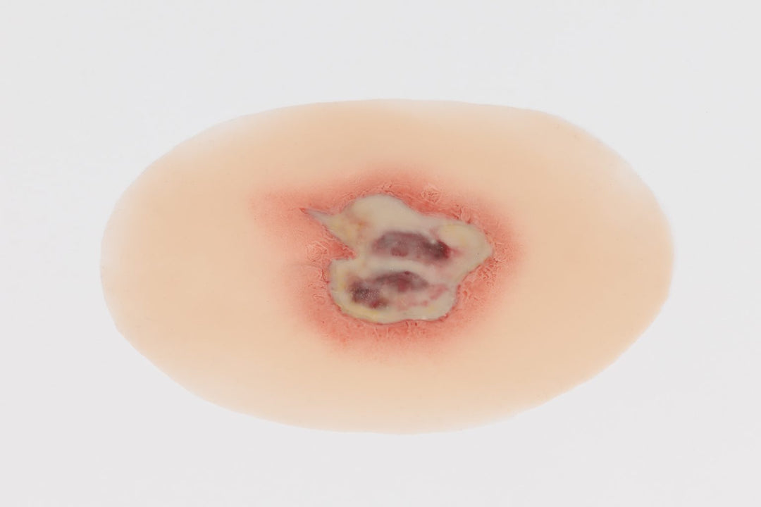 TraumaSim Infected Open Wound